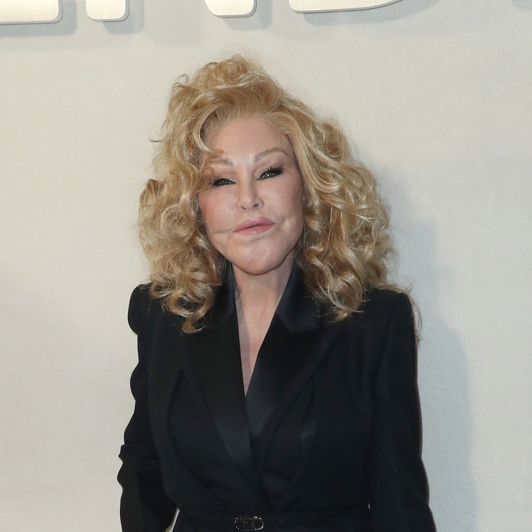 Jocelyn Wildenstein Shares Photo From Before Cosmetic Transformation Jocelyn Wildenstein Shares Photo From Before Cosmetic Transformation
